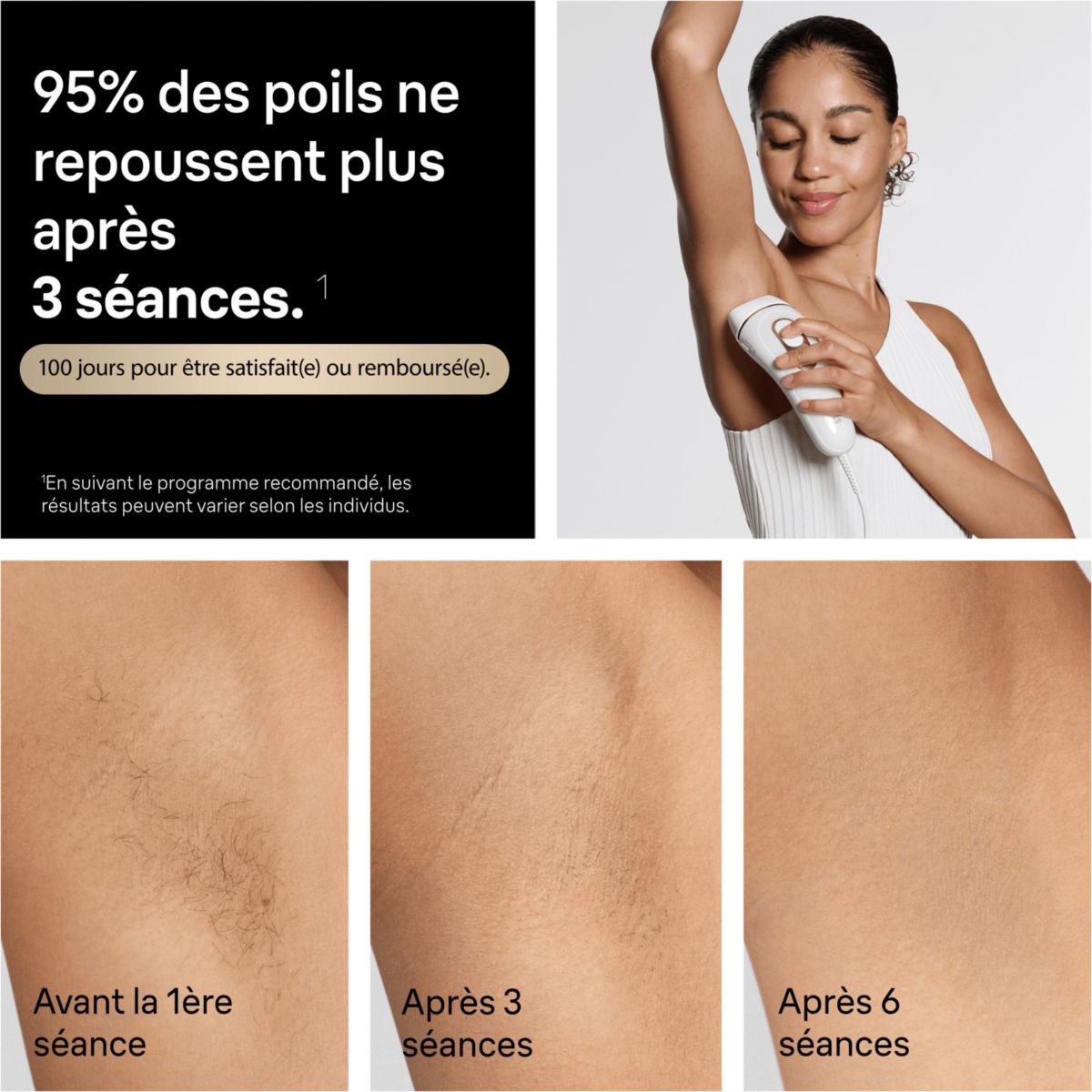 Epilateur lumière pulsée IPL PL5234 2 têtes, 1 rasoir Gillette Venus, une pochette blanc, BRAUN