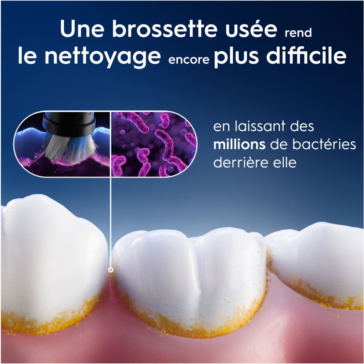 Brossette dentaire iO Gentle Care Blanc x3 couleur unique, ORAL B