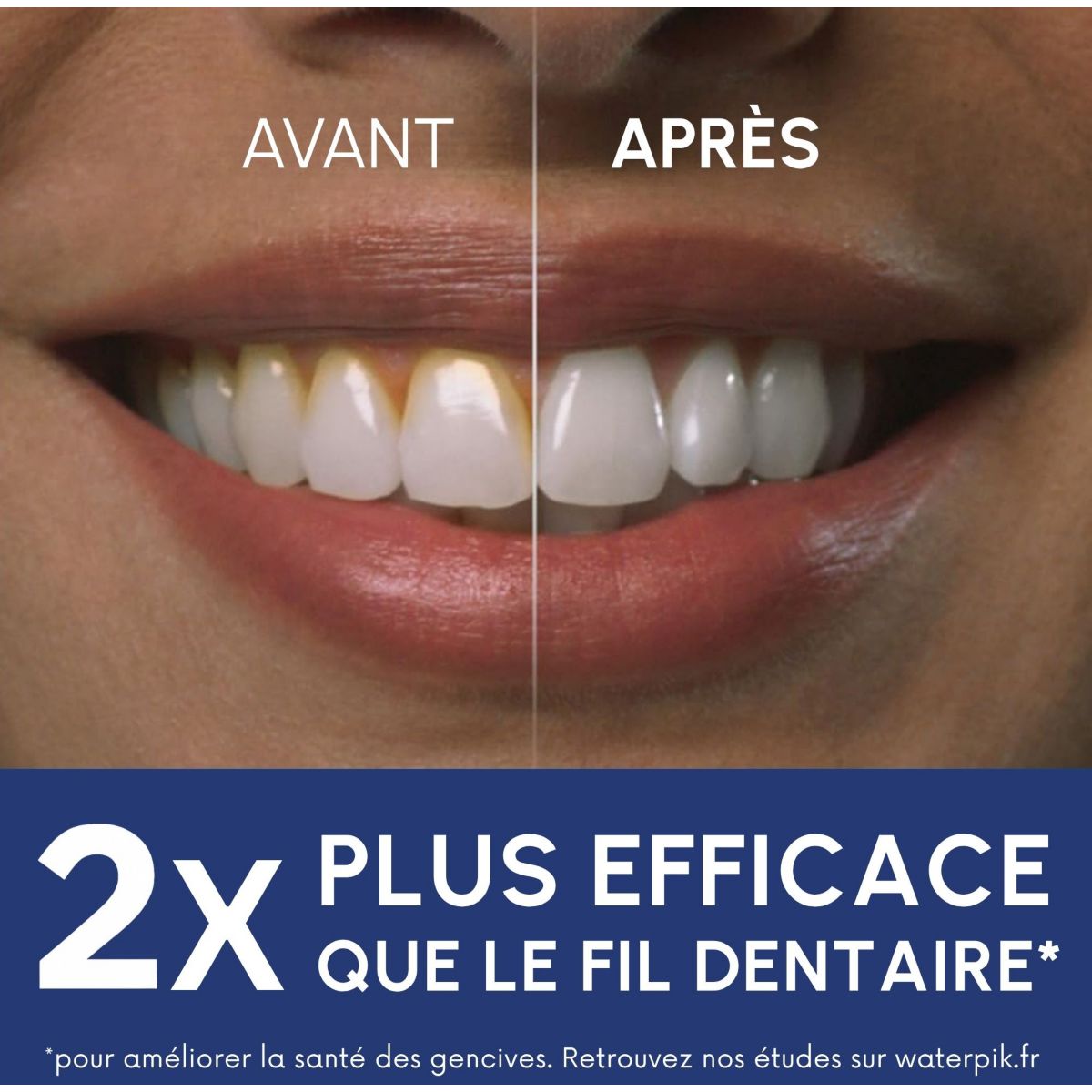 Hydropulseur WF-21 Enhance couleur unique, WATERPIK