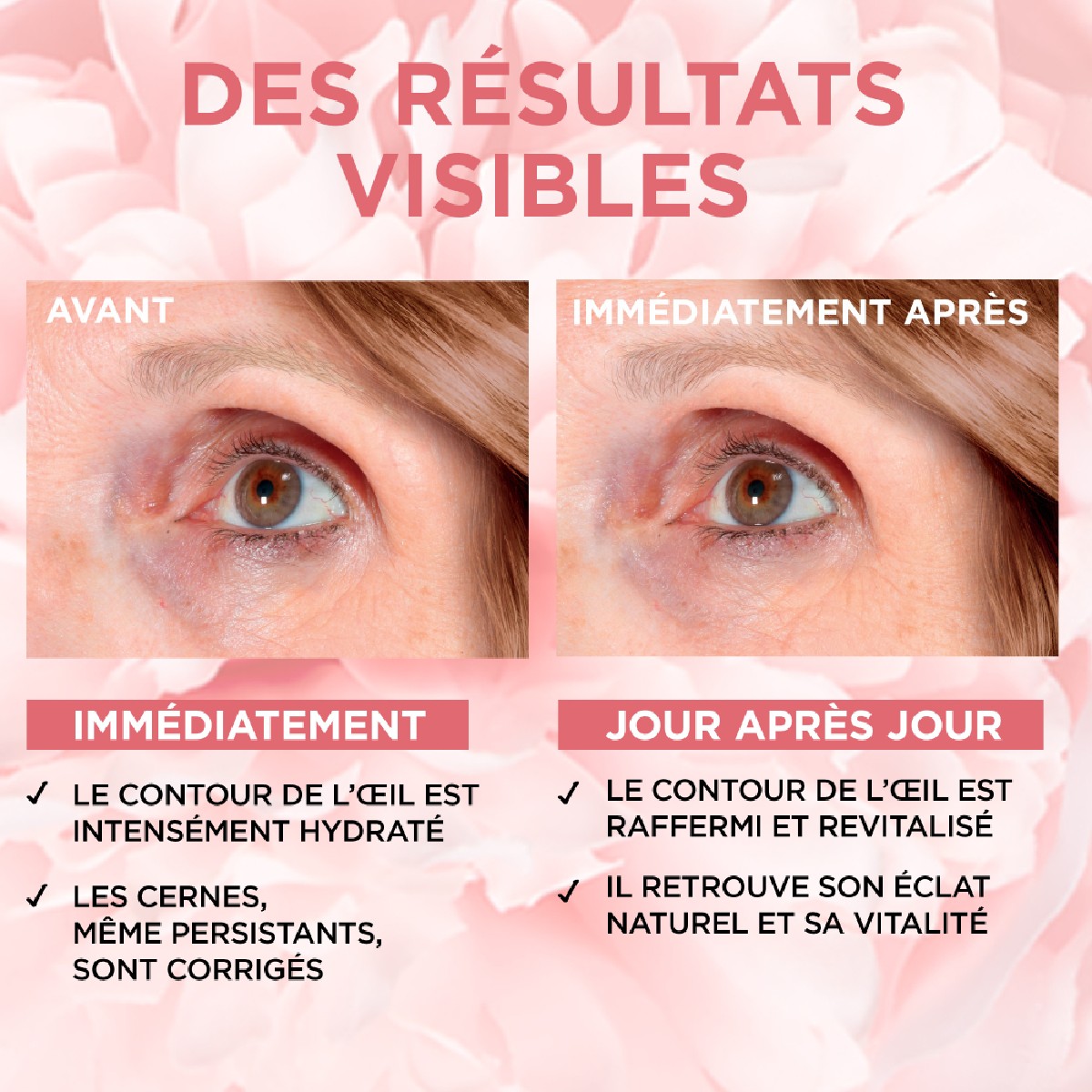 Soin Yeux Rosé Éclat Age Perfect 15ml couleur unique, L'OREAL PARIS