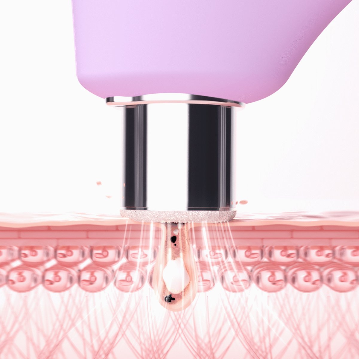 Extracteur Points Noirs Visage & Nez KIWI couleur unique, FOREO