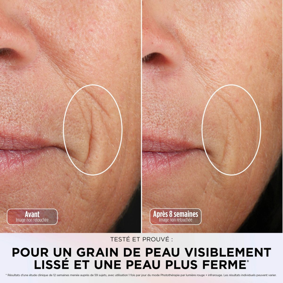 Masque LED CryoGlow avec rafraîchissement du contour des yeux Lilas couleur unique, SHARK