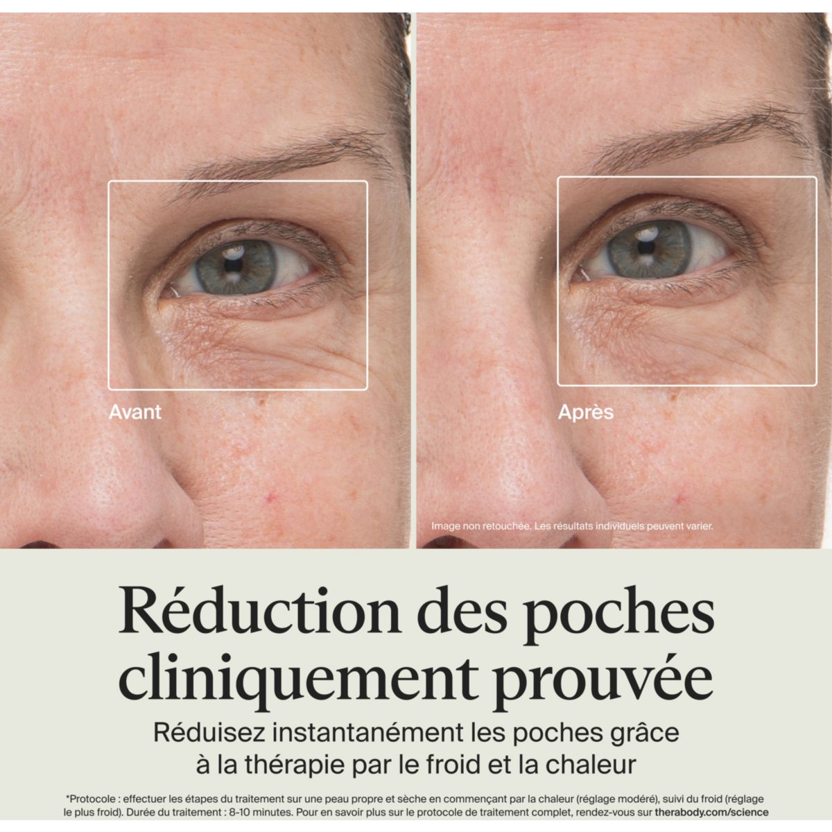Appareil éclat visage TheraFace anti-cernes blanc couleur unique, THERAGUN