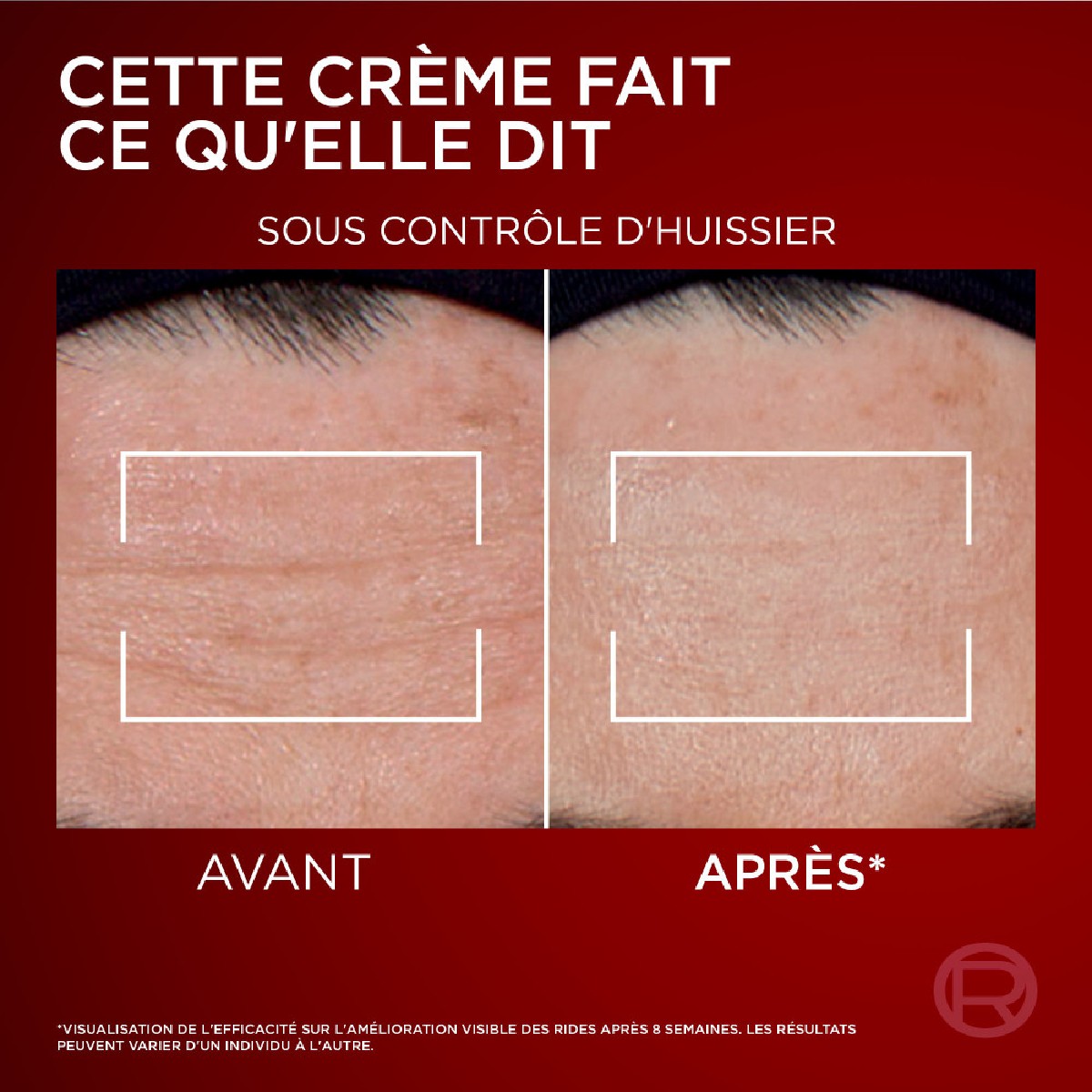 Routine Soin Revitalift Laser Soin Anti-âge 50ml + L'Oréal Paris Revitalift Laser Sérum Correcteur Anti-Âge Tri-Peptides 30ml couleur unique, L'OREAL PARIS