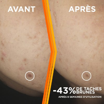 Sérum Vitamine C Anti-taches 30ml GARNIER